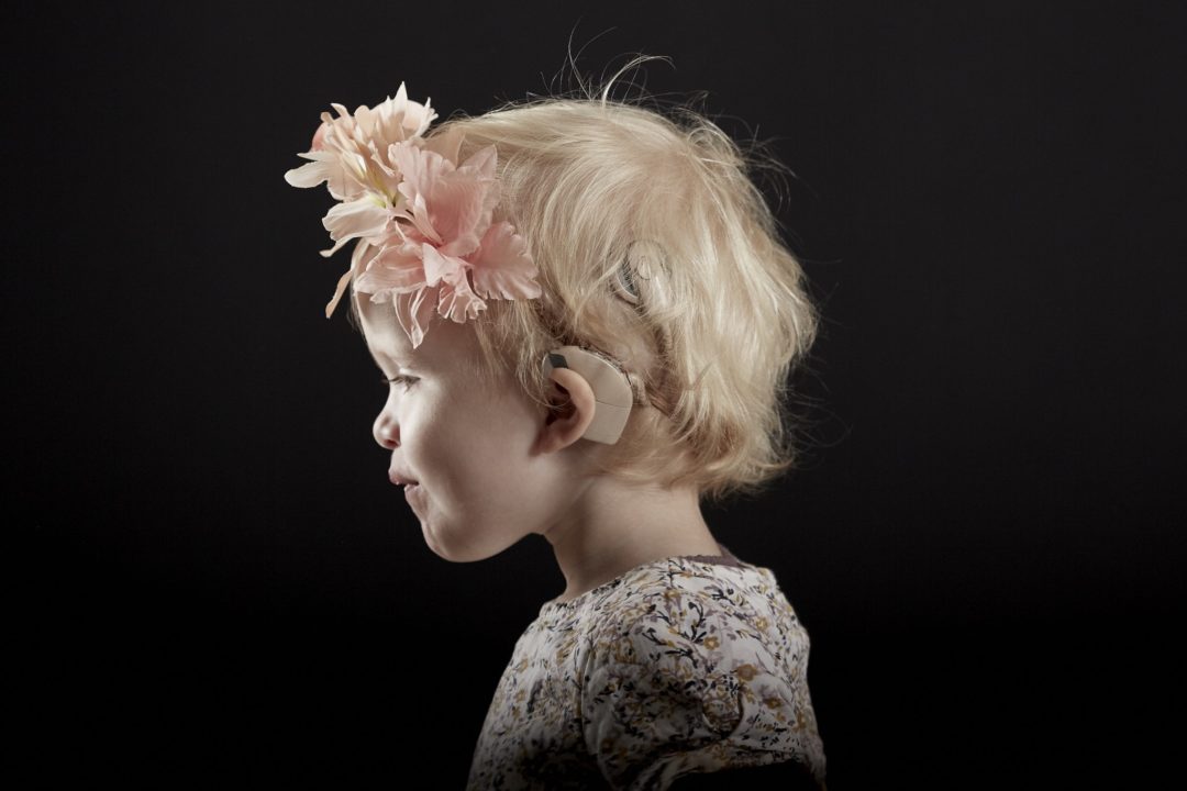 pandebånd, pandebaand, headband, cochlear implants, høreapparater